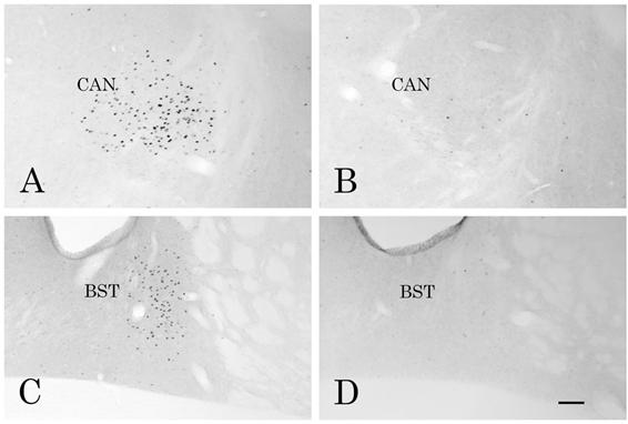扁桃体中心核および分界条床核におけるc-Fos蛋白発現を示す顕微鏡写真