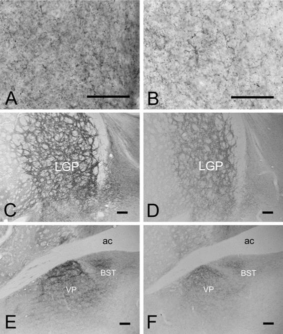 メチオニンエンケファリン（met-ENK）の免疫活性の変化を示す顕微鏡写真