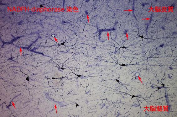 大脳皮質一酸化窒素合成細胞の顕微鏡写真