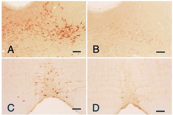 ダイオキシン胎盤母乳暴露を受けたマウス産仔と対照マウス産仔における縫線背核および大縫線核におけるセロトニン免疫陽性細胞を示す光学顕微鏡写真